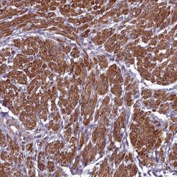 ZNF626 Antibody, Novus Biologicals:Antibodies:Primary Antibodies